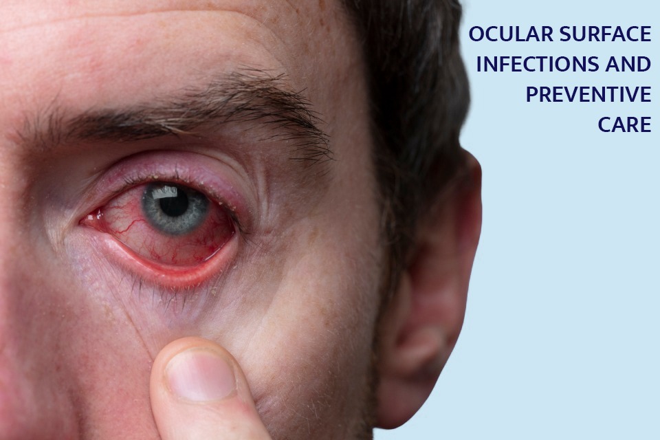 best eye hospital in Lucknow for Ocular Surface Infections , Susanjeevani Hospital